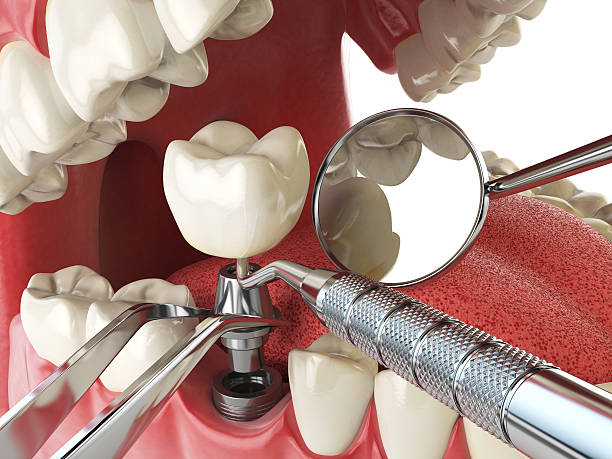 Best Emergency Broken Tooth Repair in Wrightsville, PA